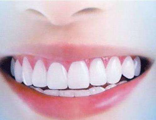 美白牙贴好不好 牙贴贴了为什么会痛  牙贴什么时候贴最好