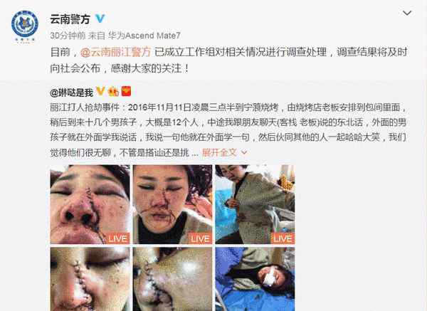 丽江毁容 女游客丽江遭毁容被录视频 警方回应：主要嫌疑人已经被控制