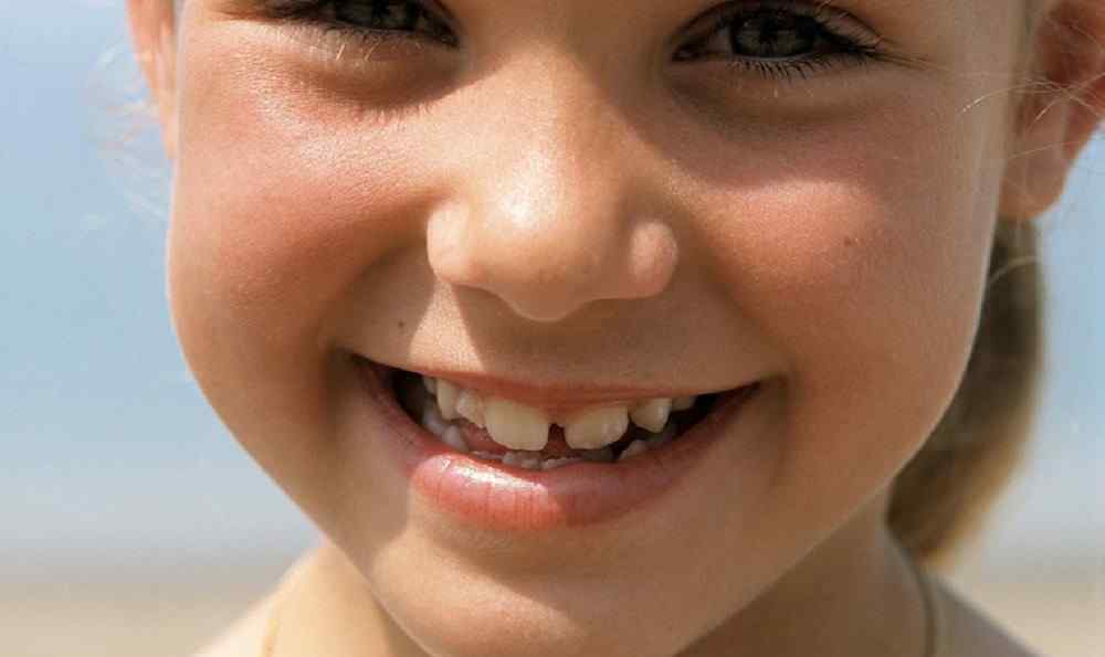 牙结石清理多少钱 牙结石怎么办 去除牙结石要多少钱？