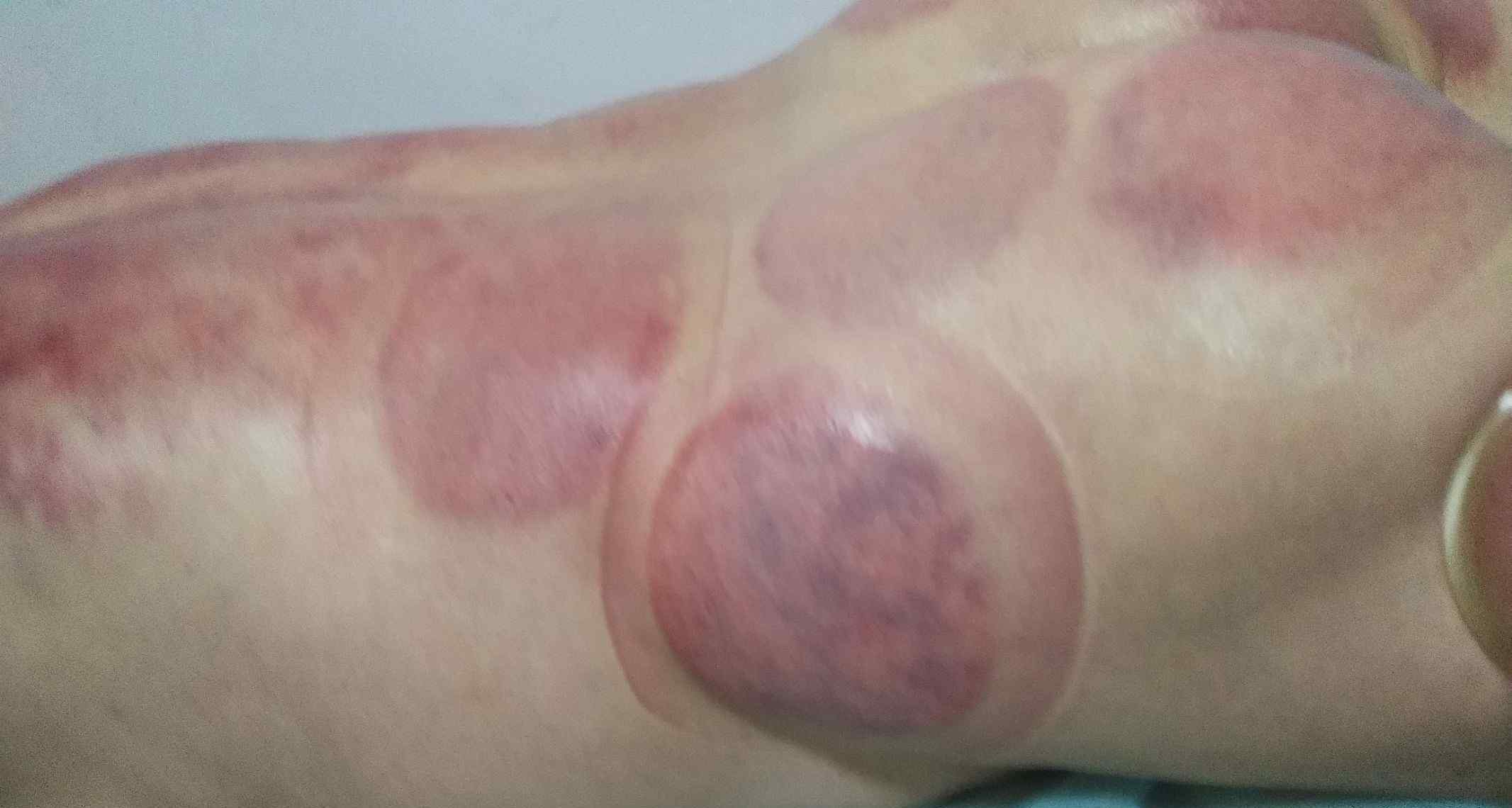 肾寒 体寒的危害：血寒，筋寒、骨寒，宫寒，肾寒，肺寒，胃寒，肝寒.久寒必痛、久痛必虚、久虚必病