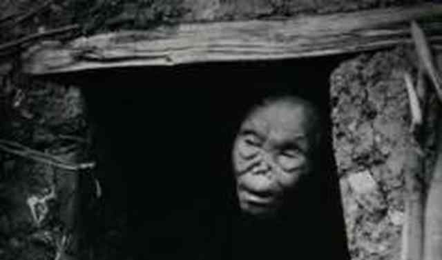令人震惊旧照片:清朝晚期民国麻风病人不忍直视,传道士在麻风村
