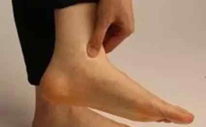 中医药学把脚跟痛的发病原因辨证论治分成三类