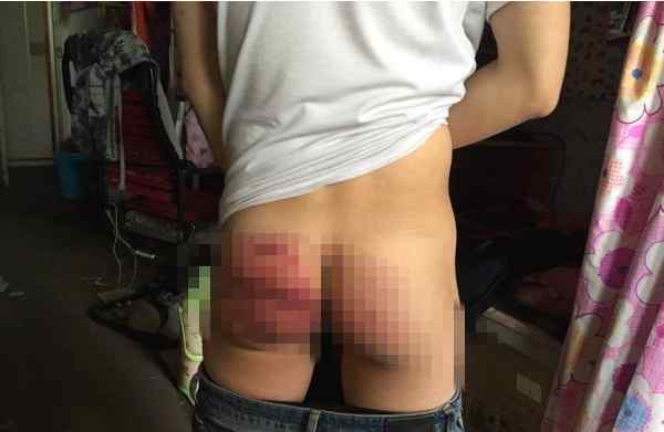 警察打死大学生 大学生屁股被警察打开花 调查结果警察被关禁闭所长停职