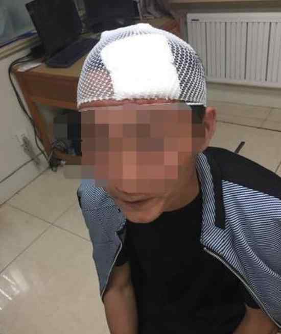 团伙抢劫打伤民警 团伙抢劫打伤民警 言语嚣张声称打的就是警察