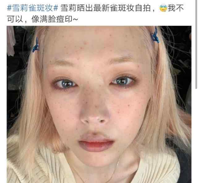 雪莉雀斑妆 雪莉晒雀斑妆自拍 扮相丑暴男粉大呼不爱了