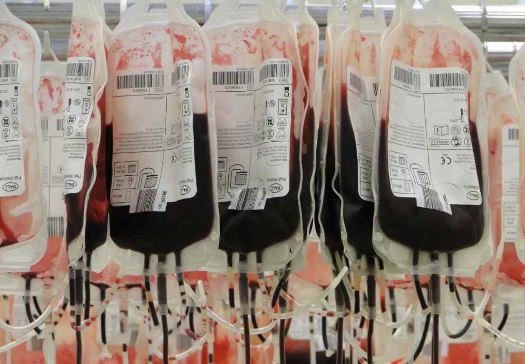 直系亲属不能输血 为什么直系亲属间不能相互输血？