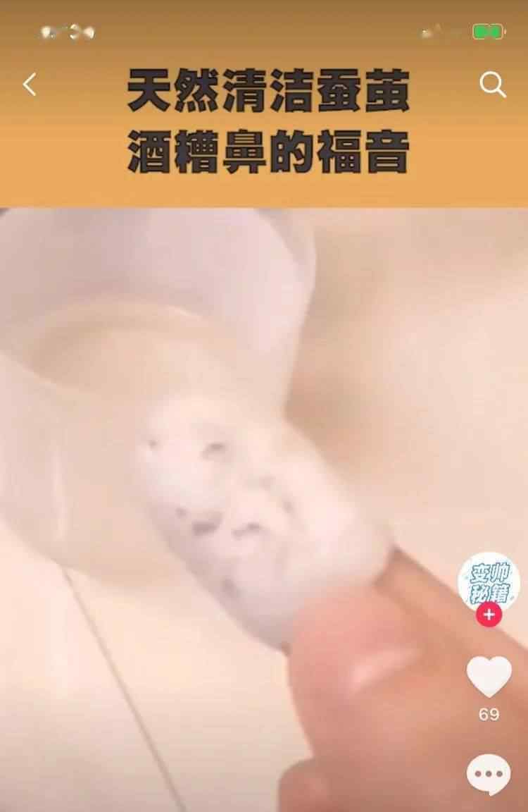 杭州市女孩刷短视频被种草“蚕茧祛黑头”,取得手发觉不但恶心想