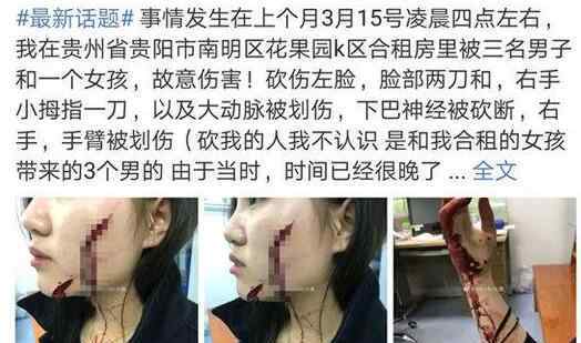 刘雪琪 女孩被砍毁容左脸缝200多针 下巴神经被砍断