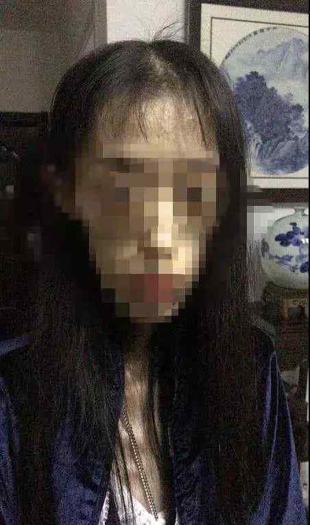 张锦明 要瘦不要命？女孩减肥剩50斤 她骨瘦如柴的样子太恐怖