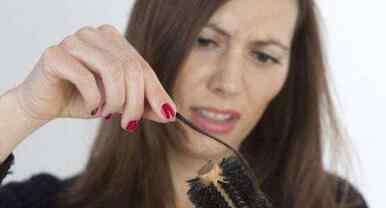 头发油腻脱发怎么治 头发油掉头发怎么办 头发油导致的掉发的治疗方法