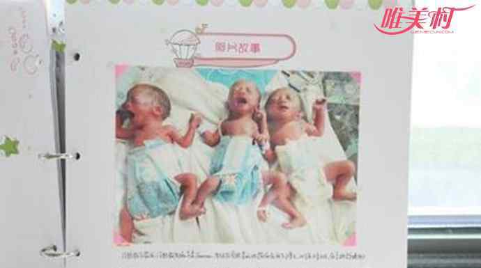 单卵三胞胎 成都女子诞下单卵三胞胎 医学上的稀奇事医院举行祝福仪式