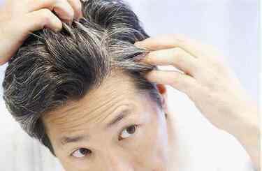 长白头发是什么原因造成的 头发白是什么原因 常见引起头发白的原因介绍