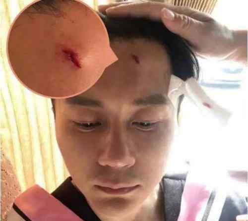 李晨受伤 李晨带伤录制《跑男》，导演对他两个字夸赞，却让无数网友表示不服