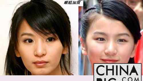 田馥甄男朋友 田馥甄整容前后照片曝光  田馥甄整容对比明显