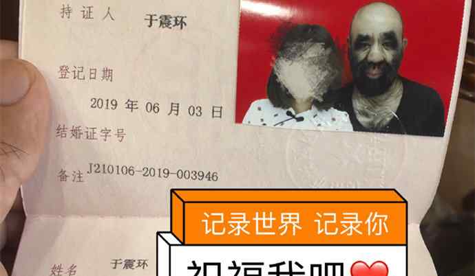 震寰 中国第一毛孩结婚了 于震寰个人资料起底老婆高颜值引热议