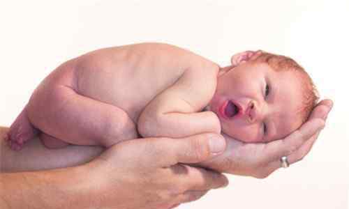 早产儿长大后的智商 早产儿的症状有哪些  早产儿长大有什么后遗症