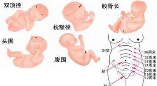 34周胎儿发育标准 34周胎儿双顶径标准是多少 34周胎儿双顶径过大怎么办