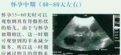 怀孕40天b超图片 怀孕母猪20天到90天的B超图像，你会看吗？