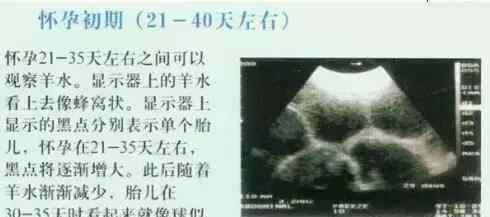 怀孕40天b超图片 怀孕母猪20天到90天的B超图像，你会看吗？