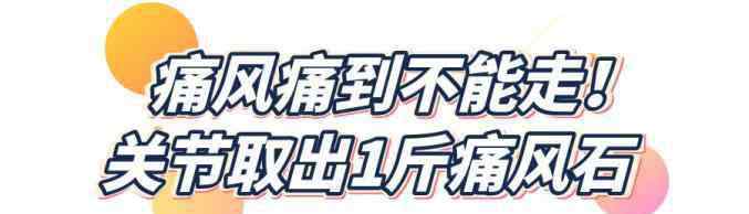 痛风饮食 关节取出一斤痛风石，史上最全食物嘌呤表在这里