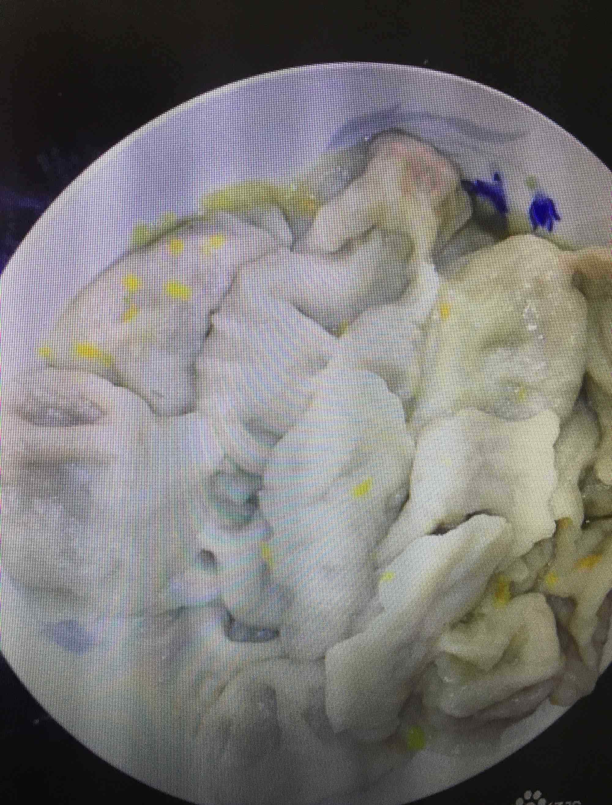 北瓜的恐怖传说 北瓜
