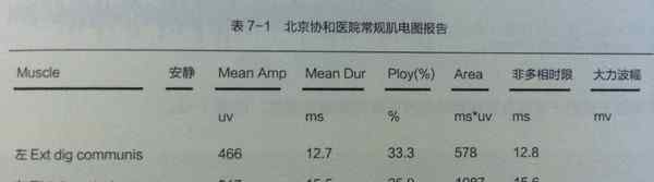 肌电图怎么做过程图片 年轻医生快来看，学习一下如何读懂肌电图~