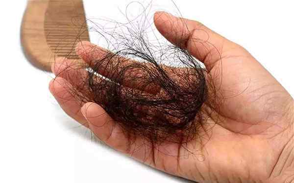 男性脱发怎么办 男性脱发严重怎么办 四个快速生发的方法