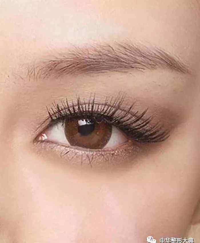 眼窝 眼窝的形成原因及修复