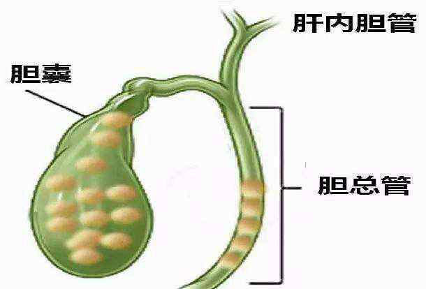 erpc 胆管结石做什么检查最清晰？B超、CT还是ERPC，哪个靠谱？