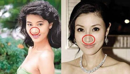 李嘉欣整容前后照片对比 鼻梁留整容伤口刻意掩盖