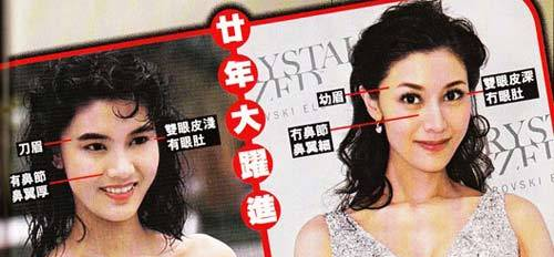 李嘉欣整容前后照片对比 鼻梁留整容伤口刻意掩盖