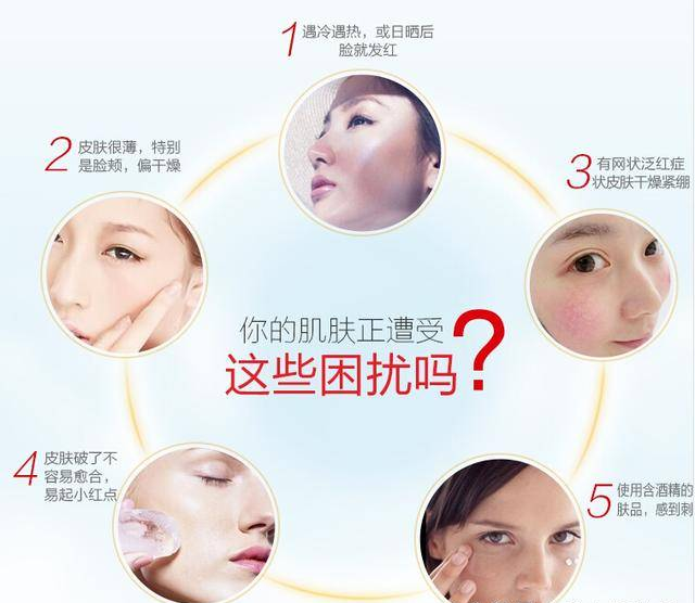 皮肤过敏怎么办？脸过敏表现出来的症状是什么？
