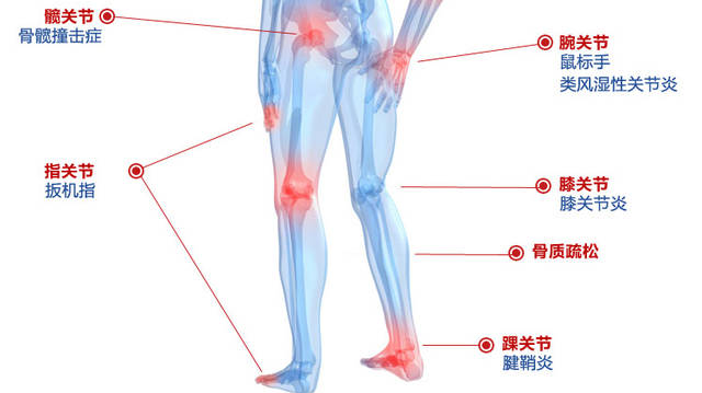 骨性关节炎如何治疗 多种有效的治疗方法