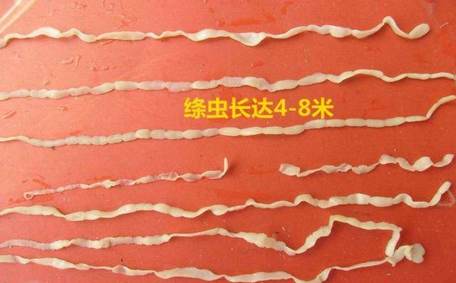 身体有这些症状要注意，可能是长了寄生虫！（中）