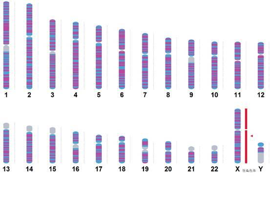 性染色体异常：你看到的也许只是表面