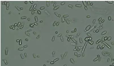 发酵工业中常用常见的酵母菌