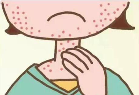 身上起红疙瘩很痒怎么办 告别红肿发痒就靠它