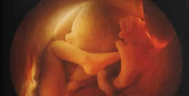 胎儿重几斤必须剖腹产？你的胎儿大小合适吗？