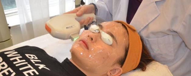 怎么去除脸上的痘印痘坑，有4种方法