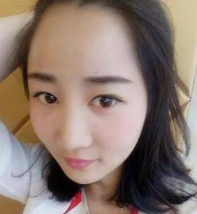 终于鼓足勇气去做了自体脂肪填充太阳穴和额头了