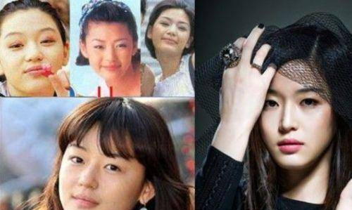 全智贤整容风波再起，有没有整容引发争议，整容专家：她是天然美