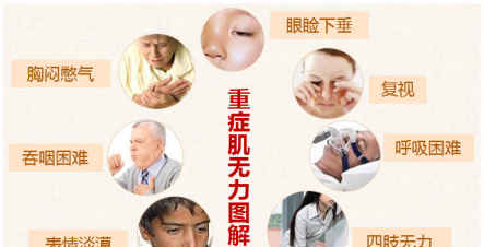重症肌无力的治疗方法有哪些?
