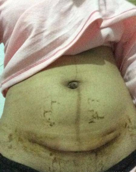 剖腹产的产妇，月子期间的护理要点，不可不看