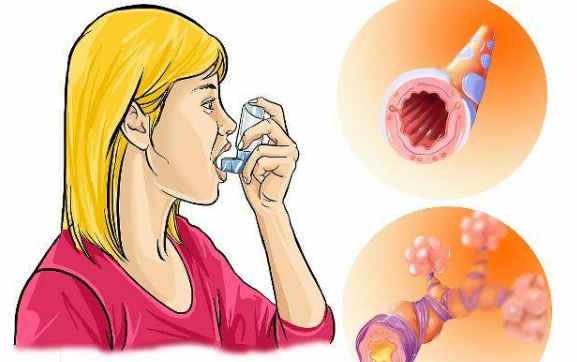 儿童哮喘长大会自愈 真相是什么呢？
