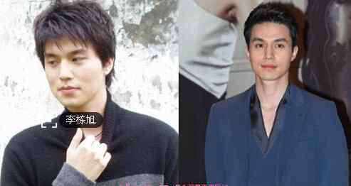 李东旭吧 李东旭个人资料 李东旭整容前后对比照片