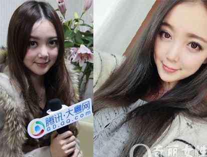汪小敏男友 汪小敏个人资料和整容前后照片 汪小敏男友是谁