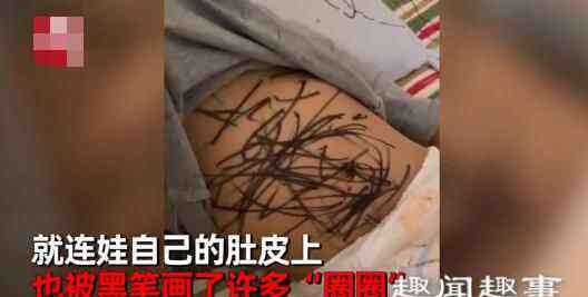 成都一女子 近日,成都一女子睡醒后发现2岁孩子十分安静,结果她掀开孩子衣服一看,瞬间崩溃了