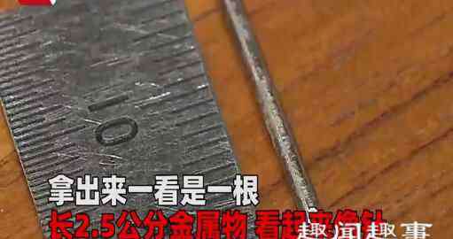 嘴巴里无缘无故出血 男子吃猪肉嚼着嚼着嘴巴突然流血 取出一看惊呆了