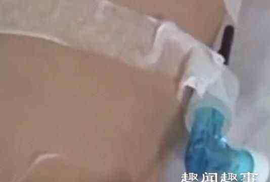 眼药水瓶 孕妇输液时抬头看眼药水瓶后崩溃 直呼孩子不敢要了原因简直令人气愤
