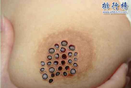 蓬蓬乳吧 【恶心慎入】莲蓬乳图片大全 莲蓬乳是什么